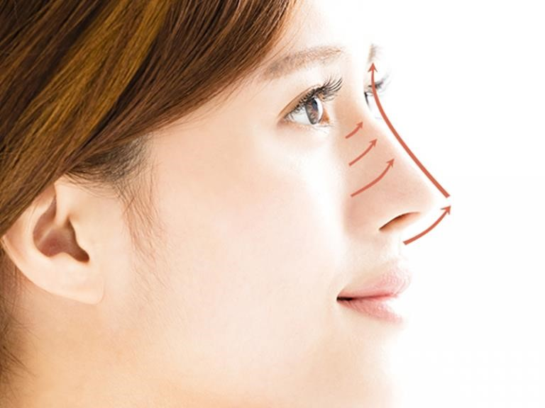 rhinoplasty surgeons near me